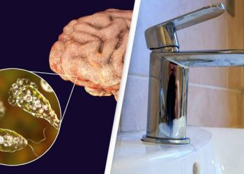 Man dies after contracting brain-eating amoeba from rinsing sinuses with tap water