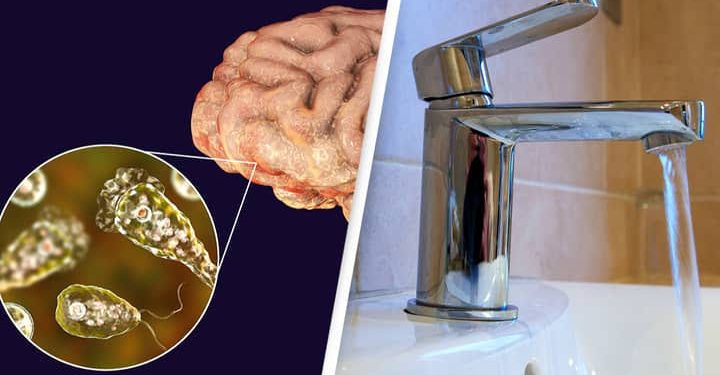 Man dies after contracting brain-eating amoeba from rinsing sinuses with tap water