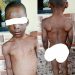Horrific photos of a child brutalized, chained for weeks by his guardian in Abia