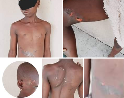 Woman arrested for allegedly torturing her 8-year-old maid with hot knife in Delta