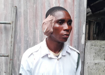 Driver bites off VIO officer’s ear in Delta