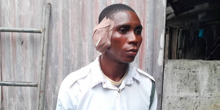 Driver bites off VIO officer’s ear in Delta