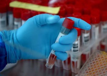 Nigeria confirms 798 cases of mouth disease in 7 months