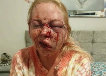 Mother left unrecognisable after being gruesomely beaten by her partner who also filmed the attack 