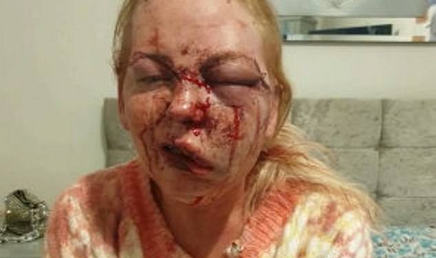 Mother left unrecognisable after being gruesomely beaten by her partner who also filmed the attack 