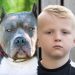 7 year old boy mauled by pitbull dog as he played with his friends at park after school