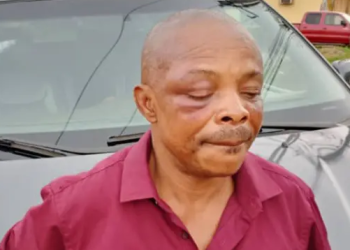 Imo Workers Protest: One Feared Dead, Others Injured