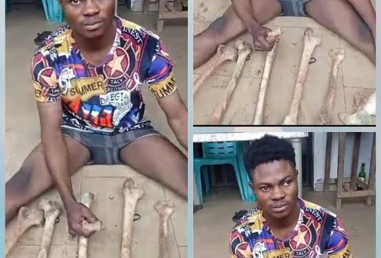 Young herbalist arrested with 11 human bones in Anambra
