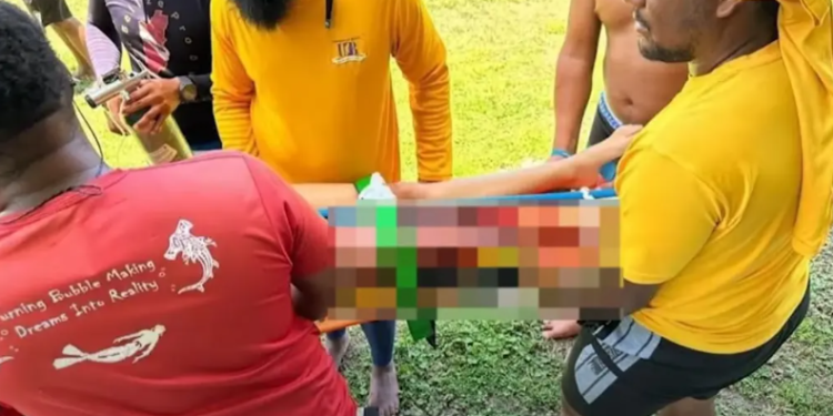 Girl 15, loses leg in shark attack during vacation