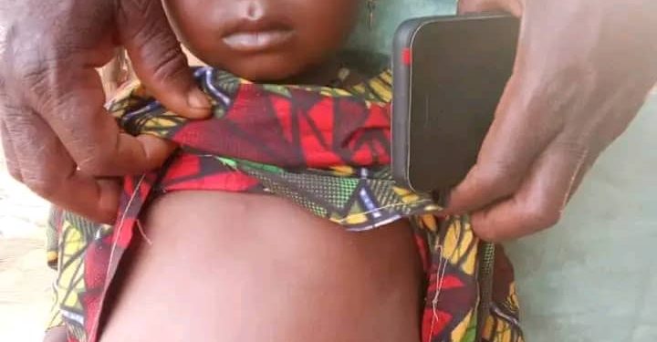 Mysterious Disease Hits Sokoto Community, 32 Children Affected