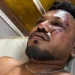 British passenger survives Air India crash that claimed 241 lives