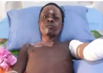 Taraba Poly student loses both hands after electrocution while hoisting PDP flag