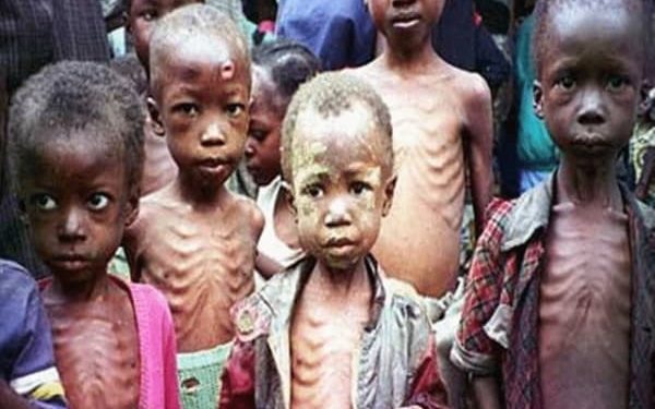 ‘420,000 Nigerian children at risk of malnutrition this year’