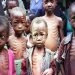 ‘420,000 Nigerian children at risk of malnutrition this year’